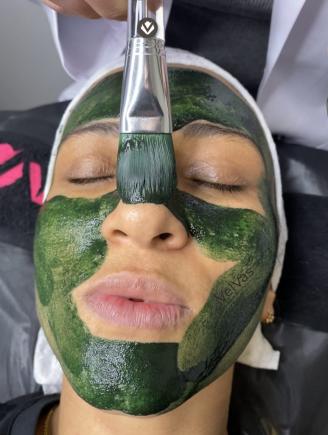 Yosun Peeling leke Tedavisi